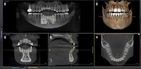 3D CONE BEAM CT Dental X Rays Heritage Dental Group