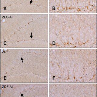 Immunohistochemistry For Dcx In The Dentate Gyrus Of Zlc A And B