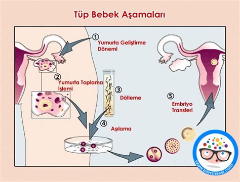 Tüp Bebek Nedir BiliminSesi Sağlık ve Teknoloji