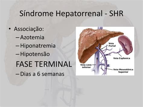 Ppt SÍndrome Hepatorrenal Powerpoint Presentation Id 2272323