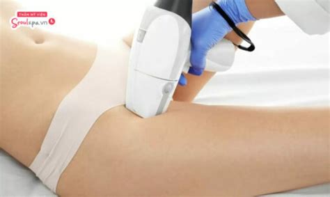 Quy trình triệt lông bikini chuẩn nhất Chia sẻ kinh nghiệm