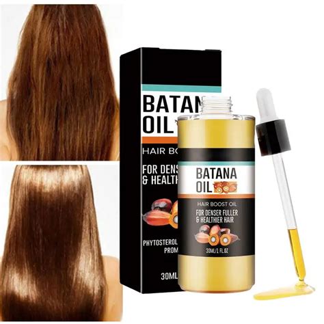 1pcs Batana Oil Hair Growth Spray Repair Baldness Hereditary Hair Loss