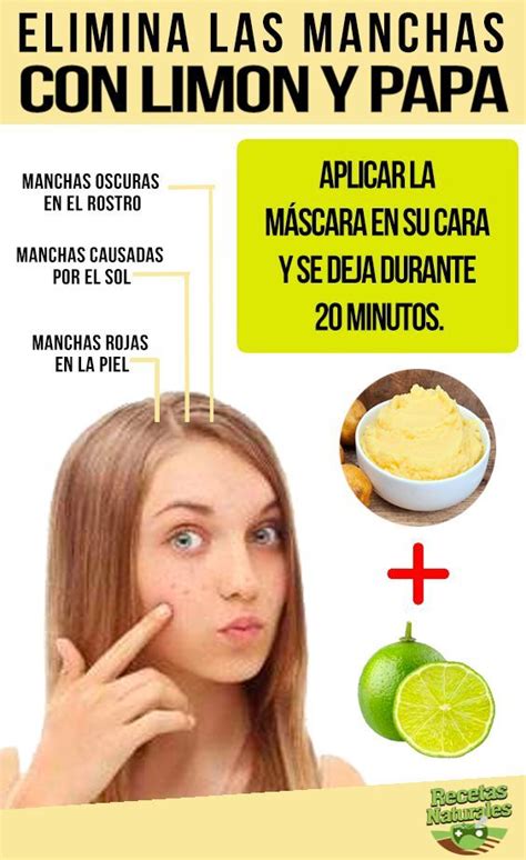 Elimine Las Manchas En Su Cara En Solo 3 Noches Con Este Remedio