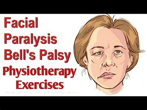 Facial Exercises For Bells Palsy Facial Palsy Youtube