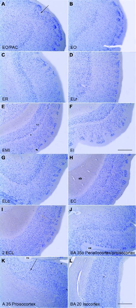 Series Of Low Power Photomicrographs Of Coronal Sections Throughout