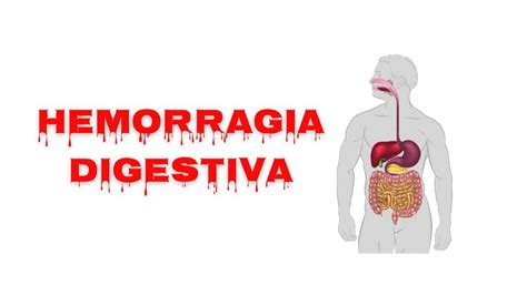 Hemorragia Digestiva Alta Y Baja D Maris Ato Udocz