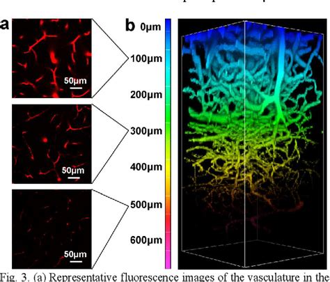 Figure From Observation Of The Blood Brain Barrier Opening By