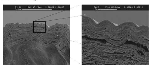 Figure From Tomographie Par Coh Rence Optique Pour La Chirurgie