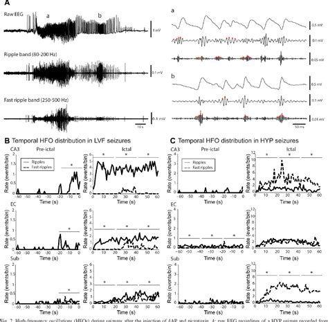 Seizure EEG Patterns