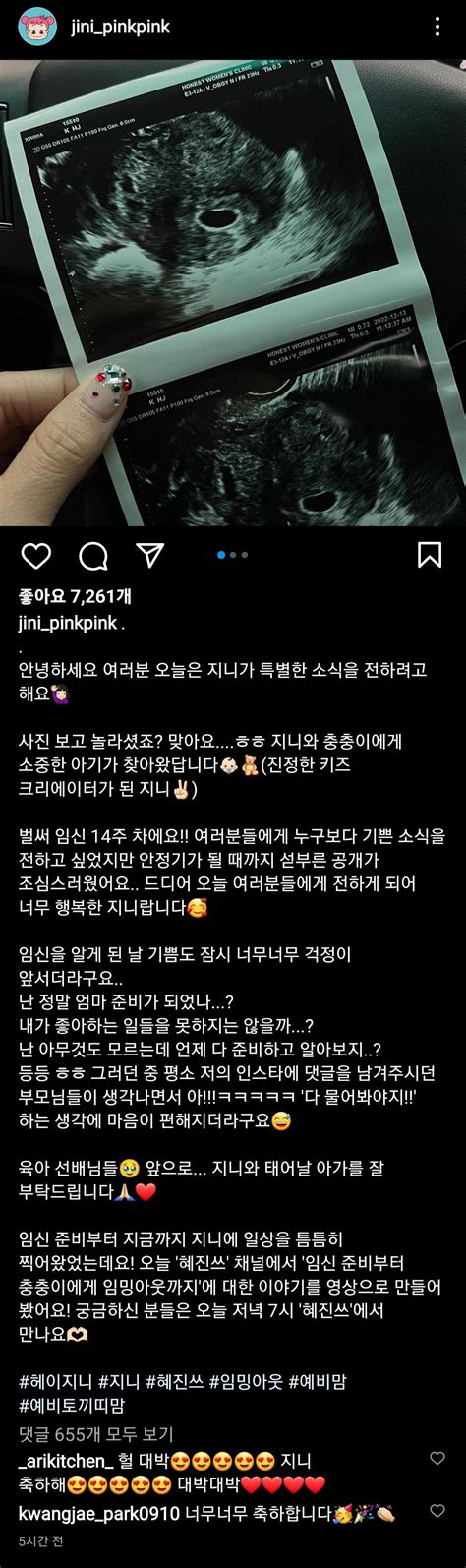 결혼 5년만에 임신한 350만 키즈 크리에이터 헤이지니