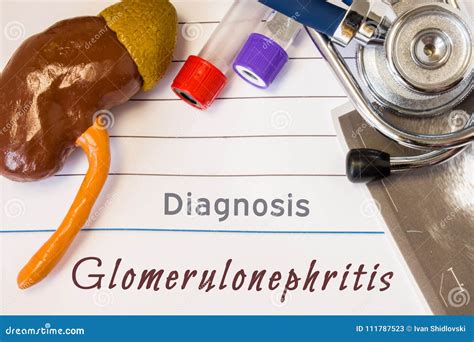 Diagnosis Glomerulonephritis Photo. Figure of Kidney Lies Next To ...