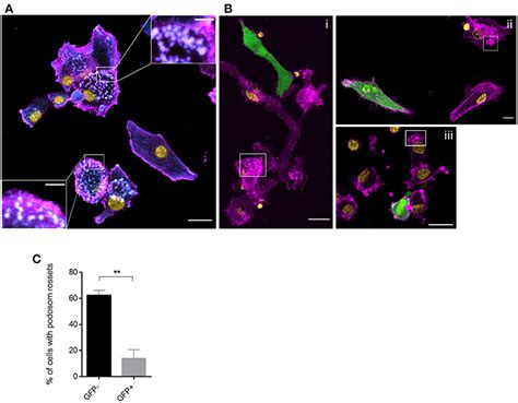 Frontiers Measles Virus Infection Fosters Dendritic Cell Motility In