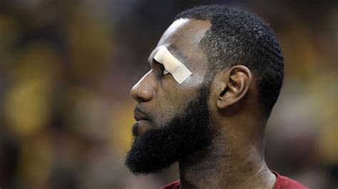 El Desafortunado Golpe Que Le Abrió La Ceja A Lebron James Infobae