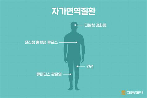 신개념 자가면역질환 치료 후보물질 Dwp212525와 Dwp213388 대웅제약 뉴스룸