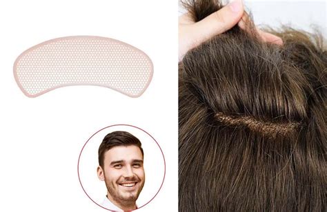 Best Hair Patch in Mumbai | Hair Patches for Men and Women | by ...