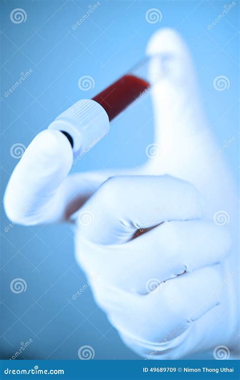 Hand Holding Blood In Test Tube Stock Image Image Of Poison Disease