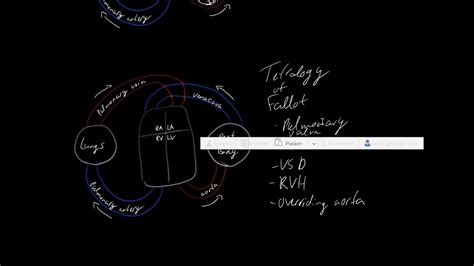 Congenital Heart Defects Cyanotic And Acyanotic Youtube