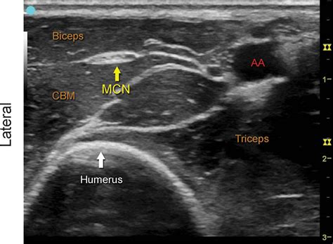 Ultrasound Nerve Anatomy