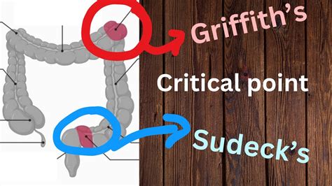 Griffith S And Sudeck S Point In One Minute Youtube