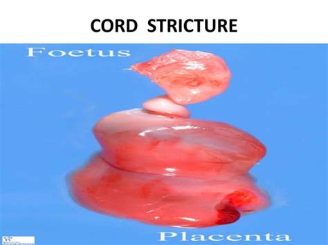 Umbilical cord and cord abnormalities | PPT