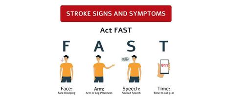 What You Should Know About Stroke Kelsey Seybold Clinic