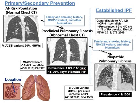 Pulmonary Fibrosis Stages