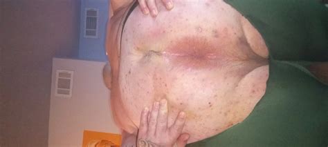 Fat Ass Nude Pics XHamster