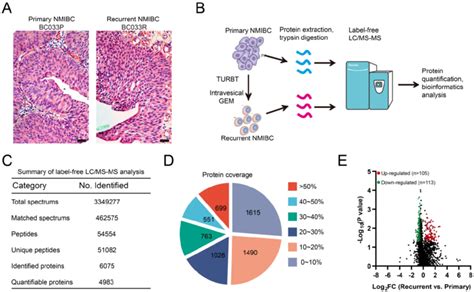 Label Free Proteomics Analysis Identifies Recurrence Related Proteomic