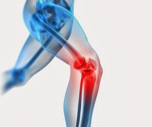 Cintilla Iliotibial Rodilla Del Corredor DELGADOTRAUMA