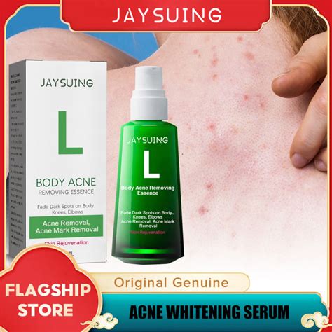 Jaysuing Body Acne Removing Essence Treatment Back Arm Neck Knee Elbows