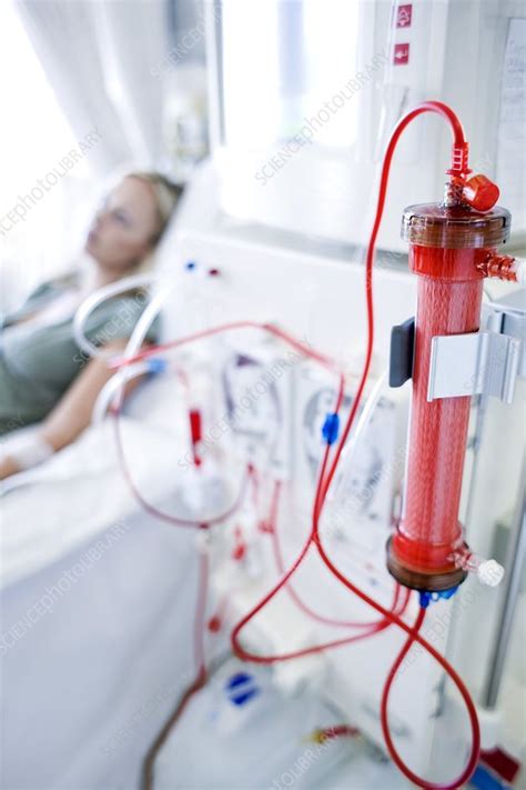 Kidney Dialysis Stock Image F0029351 Science Photo Library