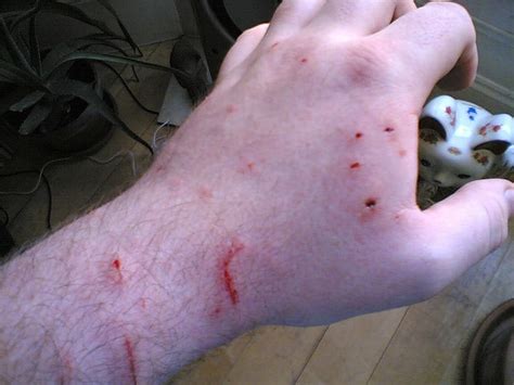 How Do You Know If A Cat Bite Is Infected Cat Lovster