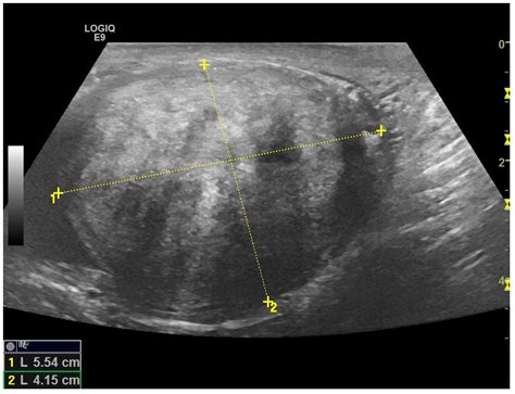 Medicina Free Full Text Multiparametric Ultrasound Diagnostic