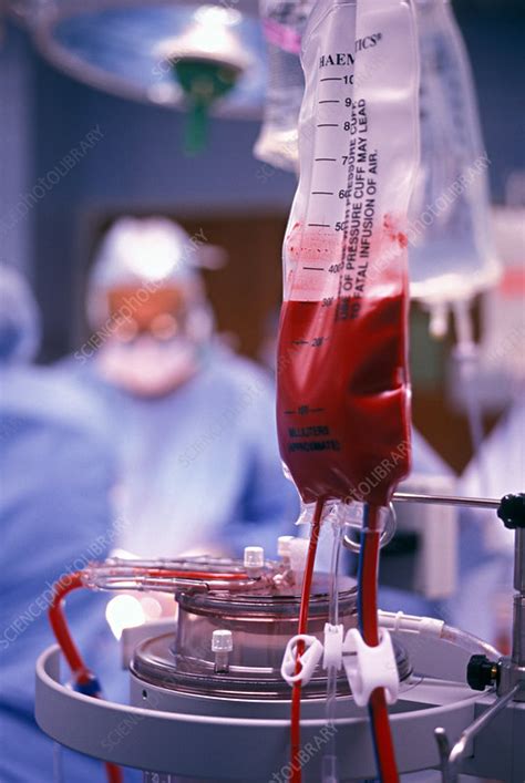 Blood Transfusion Stock Image M Science Photo Library