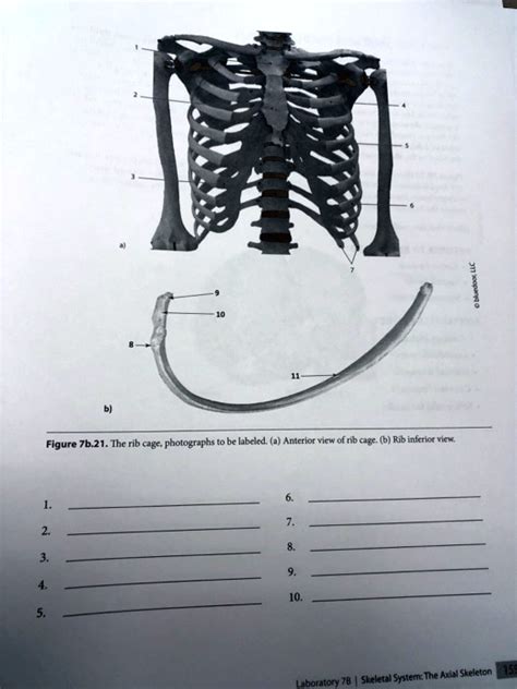 SOLVED: Please help with labeling the rib cage. Figure 7b.21. The rib ...