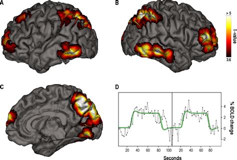 Figure From Neural Correlates Of Dream Lucidity Obtained From