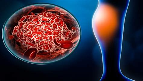 Peripheral Vascular Disease – HMDODLLC