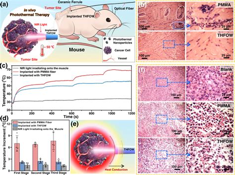 Controllable Photothermal Therapy Applied By The Thfow A Schematic