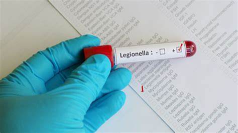 Legionella - The symptoms to look out for | Phoenix Health & Safety