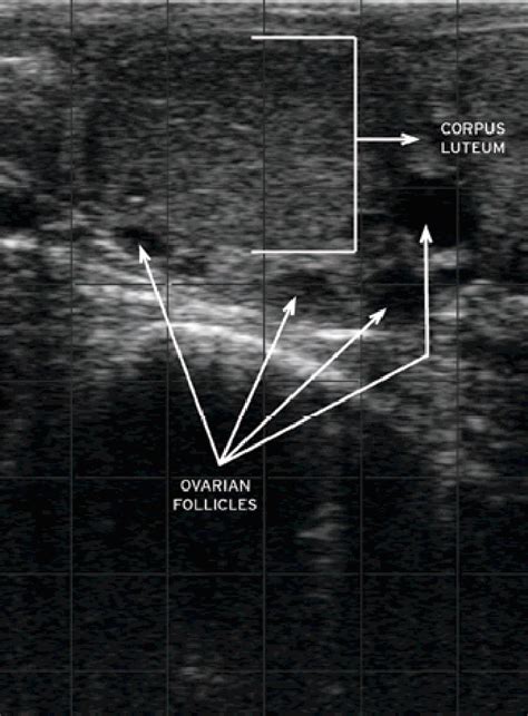 Ultrasound image of ovary with surrounding follicles [29]. | Download ...