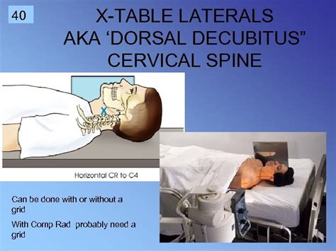 1 Cervical Spine Rtec 124 Week 6 Rev