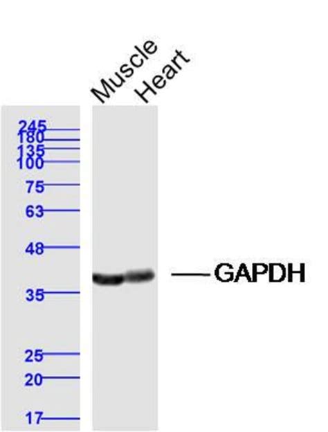 Gapdh Rabbit Anti Human Polyclonal Bioss L Unconjugated