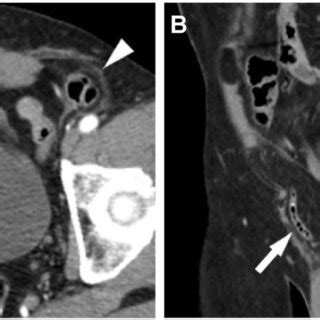 Computed Tomography Images Contrast Enhanced Axial A And Delayed