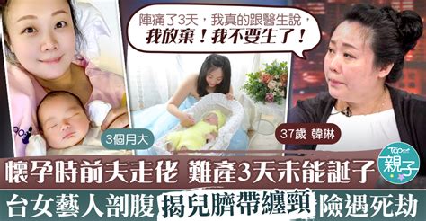 【誕子辛酸】懷孕時前夫走佬難產3天未能誕子 台女藝人剖腹揭兒臍帶纏頸險遇死劫