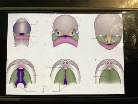 Embri Sz Jpad Diagram Quizlet