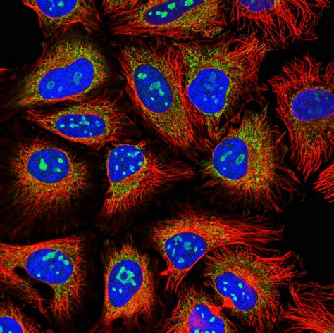 Multi-class, multi-label classification of Human Protein Atlas images ...