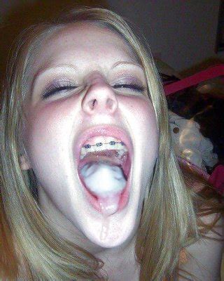 Braces Porn Pics Xxx Photos Sex Images App Page Pictoa