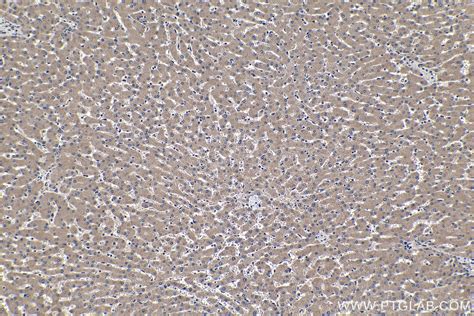 IHCeasy TRIM24 Ready-To-Use IHC Kit KHC1176 | Proteintech 