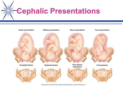 Craniosacral Therapy Google Search Results Labor Delivery Tag Image