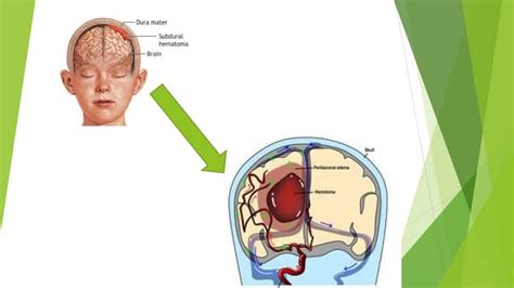 ASSESSMENT OF ICP - Copy.pptx